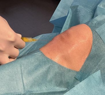 Injektionen mit Orthobiologics