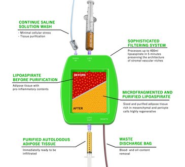 Bioregenerative Therapie